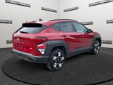 2024 Hyundai Kona 2.0L Preferred image 5